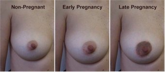 پستان ها در بارداری