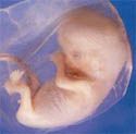 تصویر جنین در هفته 10 بارداری
