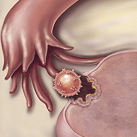  سیکل قاعدگی چیست- مراحل تخمک گذاری در پریود