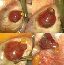 تصویر آزاد شدن تخمک ، فولیکول ، اندازه فولیکول ، تخمک گذاری ، عکس واقعی تخمک گذاری - هفته 2 بارداری