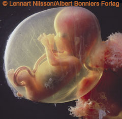 تصویر جنین در هفته 17 بارداری