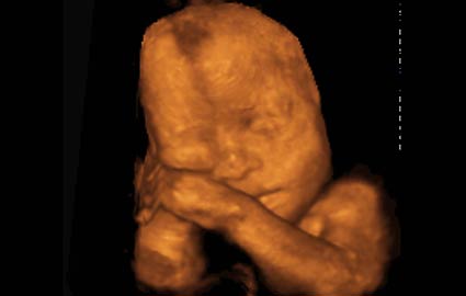 تصویر جنین در هفته 25 بارداری