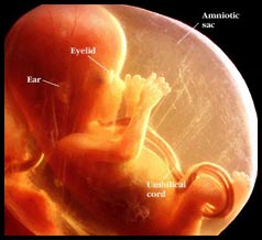 تصویر جنین در هفته 13 بارداری