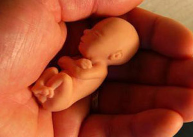 سقط جنین - دلایل سقط جنین - جلوگیری از سقط جنین